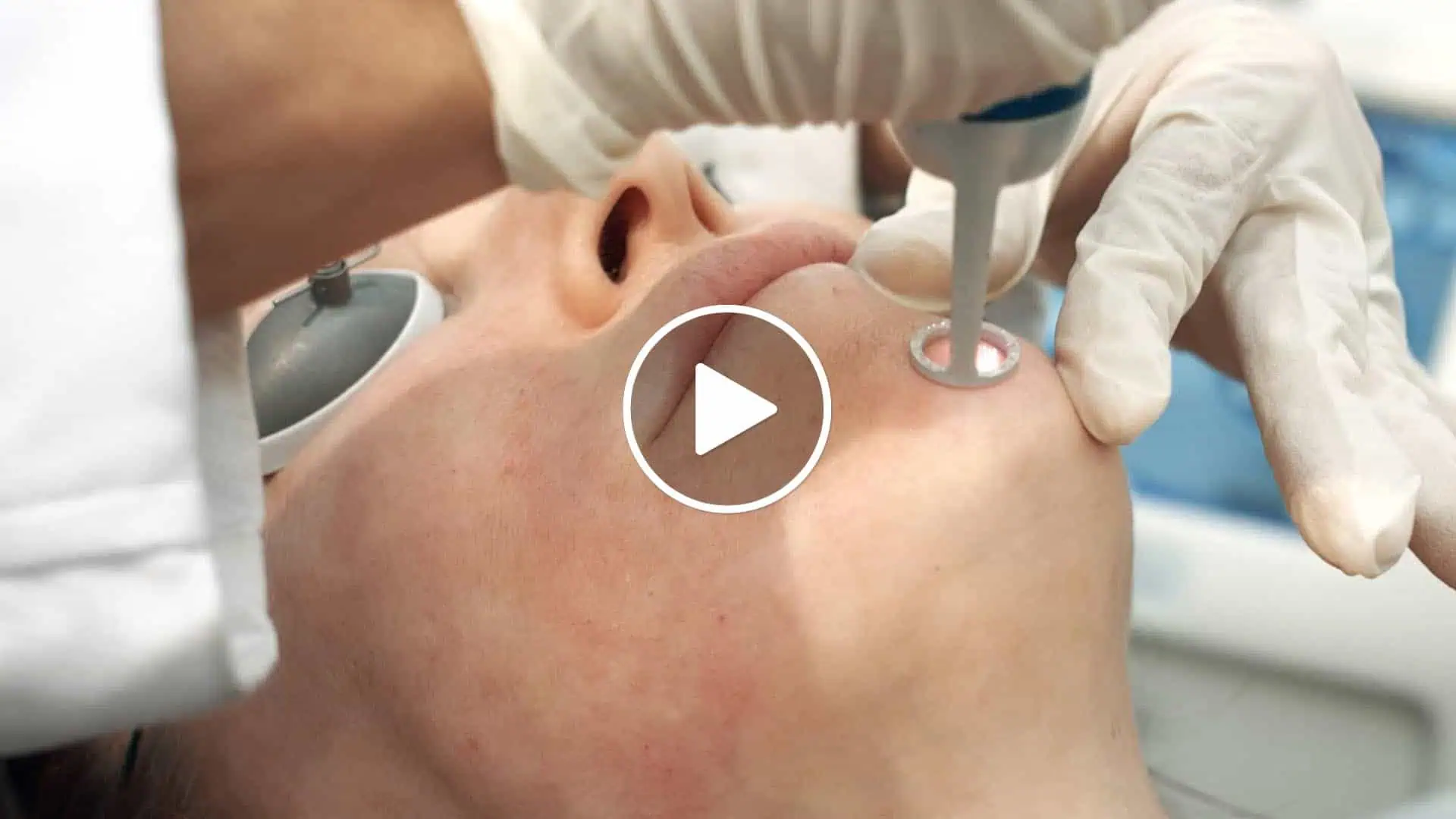 PicoWay Laser by Riverchase Dermatology in Florida